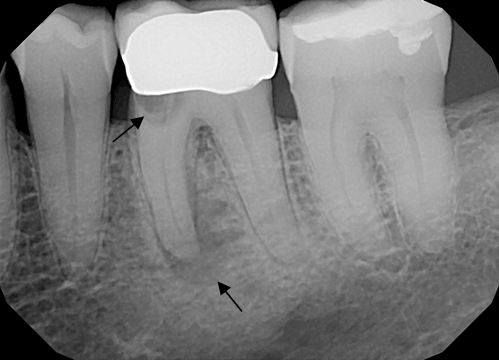 dentalimplant1.png